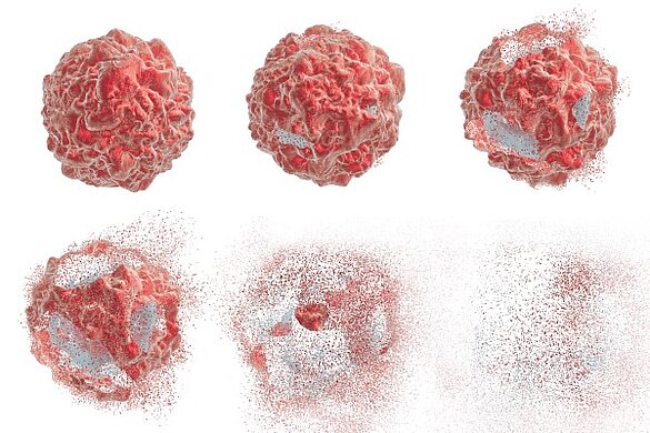 PI Ceramic Destruction of a tumor cell