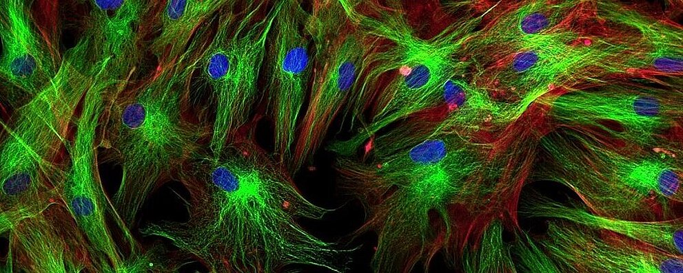Fluorescence Microscopy